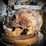 Human skull with mandible