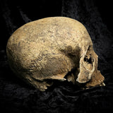 Human skull
