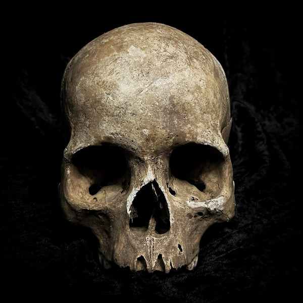 Human skull