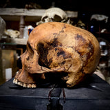 Human skull