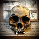 Human skull