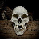 Medically prepared human skull