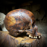 Human skull