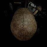 Human skull