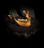 A mandible