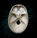 Medically prepared human skull