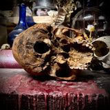 Human skull