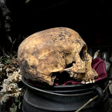 Human skull