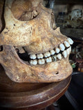 Human skull with mandible and brass teeth
