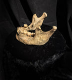 A mandible