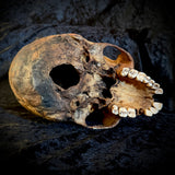 Item 15. Human skull