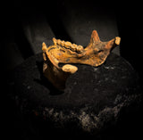 A mandible