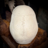 Medically prepared human skull