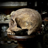Human skull