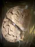 A human brain