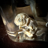 Medically preserved fetal specimen