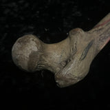 Human femur bone