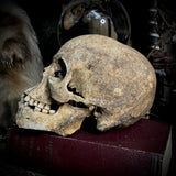 Human skull with mandible