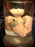 Item 3. Fetal lungs and heart