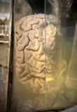 A human brain