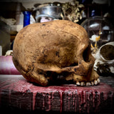 Human skull