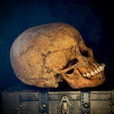Item 1. Human skull with mandible