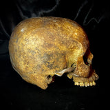 Item 18. Human skull