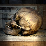 Human skull with mandible