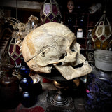 A human medical skull