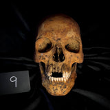Item 9. Human skull with mandible