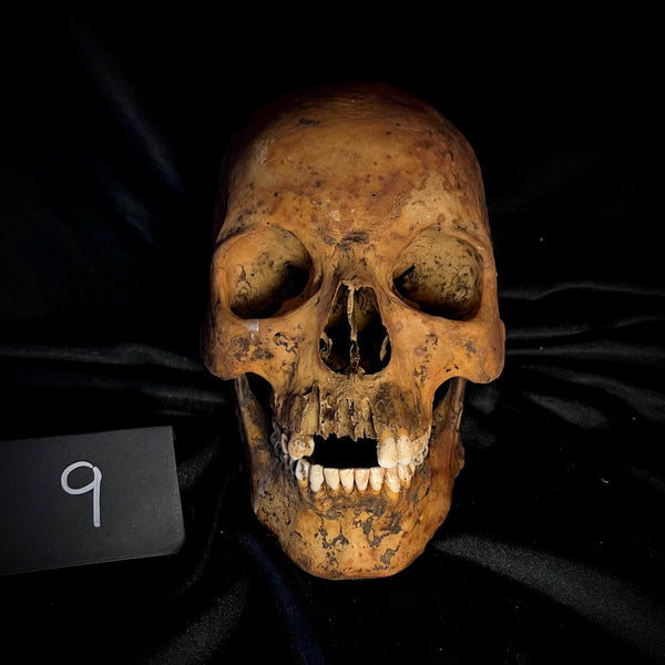 Item 9. Human skull with mandible