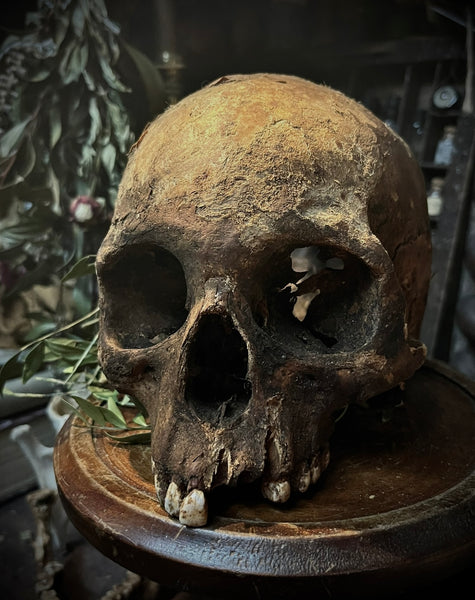 A human skull