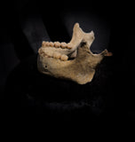 A mandible