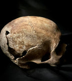 A human skull