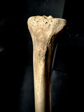 Human tibia (shinbone)