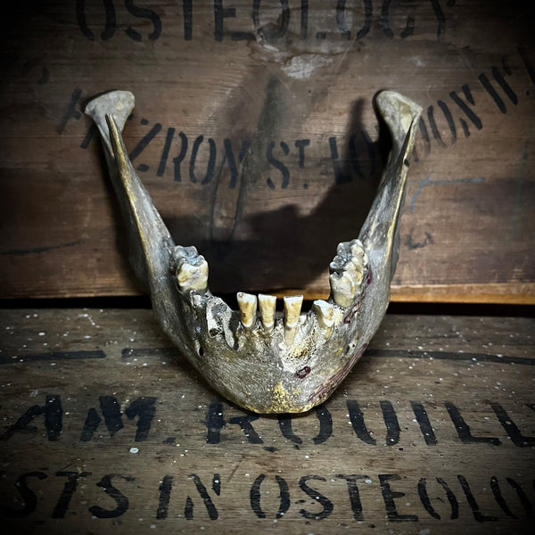 A mandible