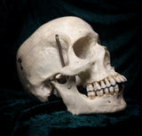 Medically prepared human skull
