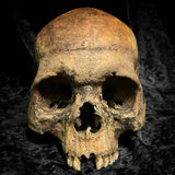 Human skull