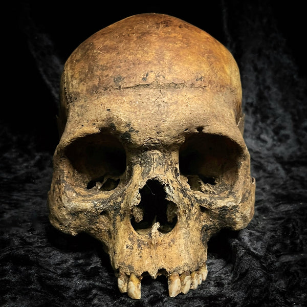 Human skull