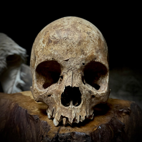 Human skull