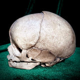 Human fetal skull