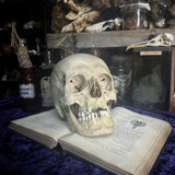 Medically prepared human skull