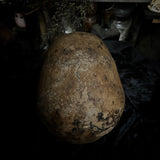 Human skull