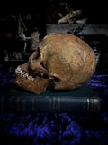 Human skull