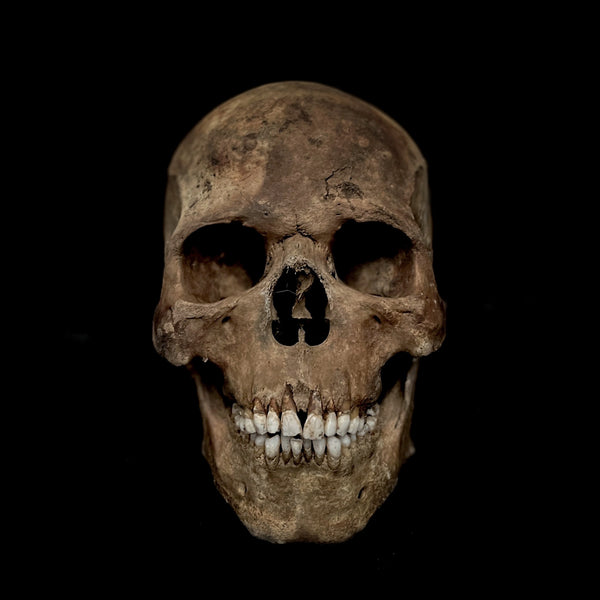 Extremely large Human skull with mandible