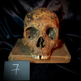 Item 7. Human skull