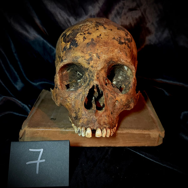 Item 7. Human skull