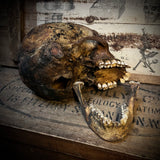 Human skull with mandible