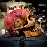 Human skull with mandible