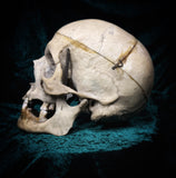 Medically prepared human skull